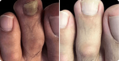 Renate Hoffmann Vorher Nachher