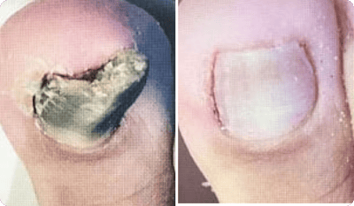 Christa Schneider Vorher Nachher