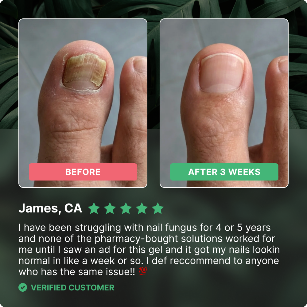 Dermafix - Before & After Results