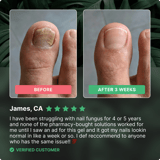 Dermafix - Before & After Results - Thumbnail