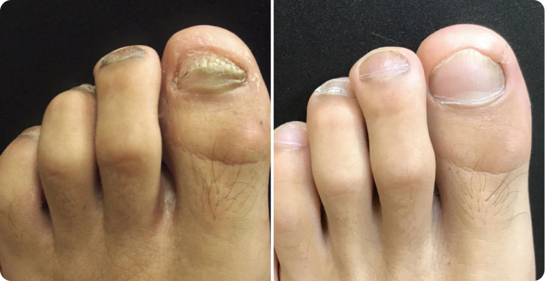 Robert Chen before after