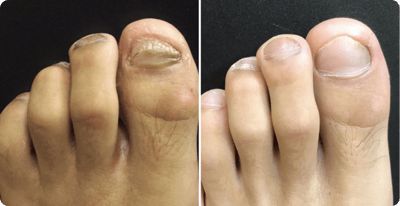 Klaus Müller Vorher Nachher