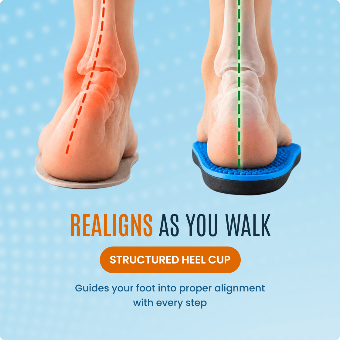 Mitisole insoles, image 7 of 7
