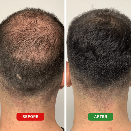 Before and After Treatment Results