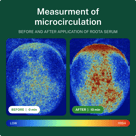 Roota Hair Growth Product - View 4 - Thumbnail