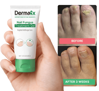 Dermafix before and after
