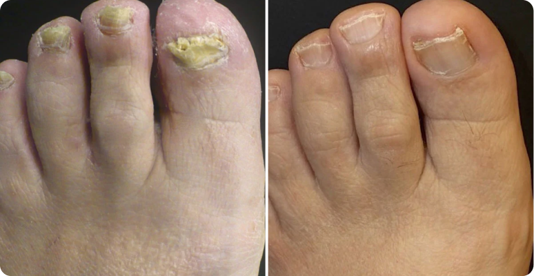 Sarah Mitchell before after