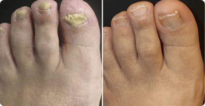 Helga Schmidt Vorher Nachher