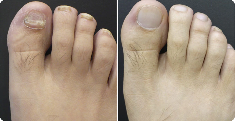 Linda Ramirez before after