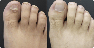 Ingrid Weber Vorher Nachher