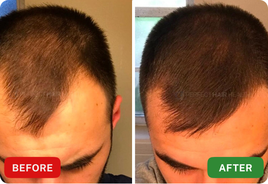 Lukas M. before after