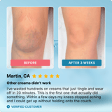 Dermafix - Before & After Results - Thumbnail