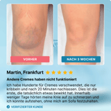 Dermafix - Before & After Results - Thumbnail