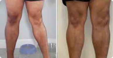 Elias S. before after