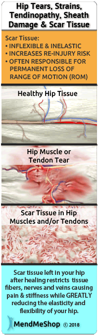 scar tissue restricts tissue fibers