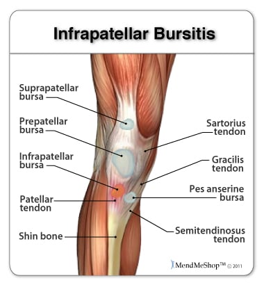 Injury below store knee cap