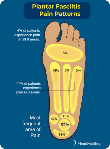 plantar fasciitis pain location statistics