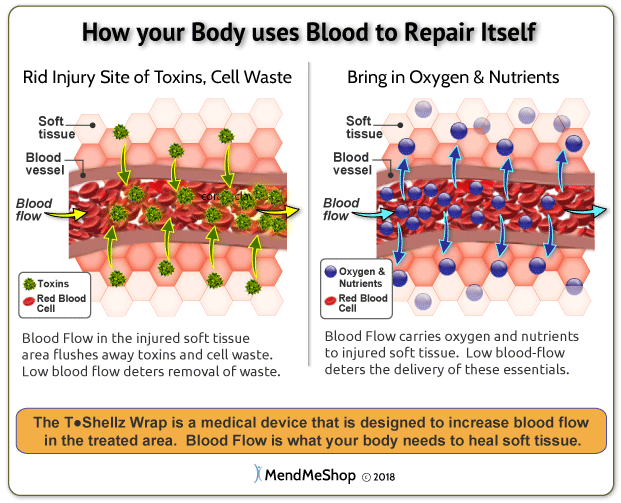 soft tissue healing is correlated with blood circulation