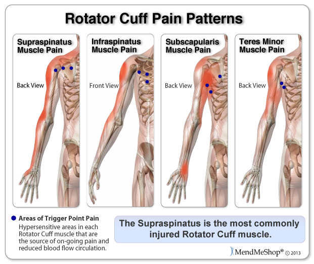 Rotator Cuff Tear Symptoms