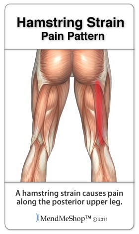 pulled hamstring pain pattern