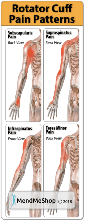 Pain Pattern Rotator Cuff