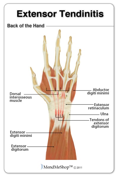 Extensor Tendons back of hand