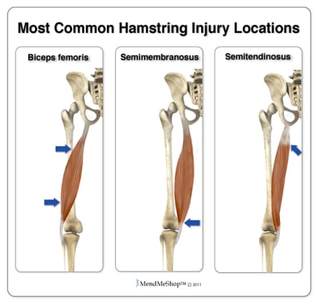Tight lateral hamstring hotsell