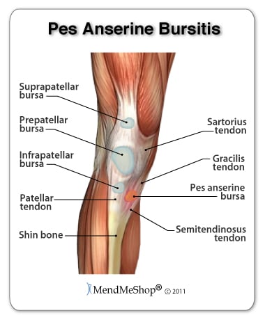 Pes anserine bursitis location