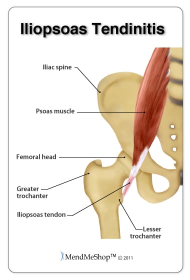 Hip Flexor Muscles  Anatomy Of The 5 Major Hip Flexors