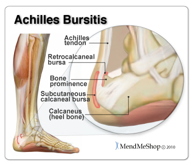 there are two achilles bursae
