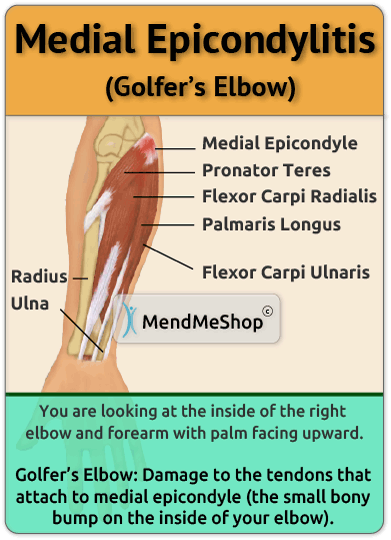 golfer's elbow muscles tendons