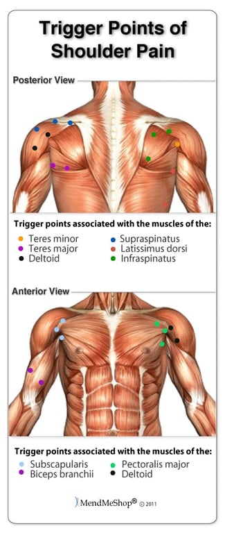 Shoulder Trigger Points