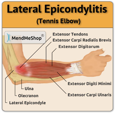 Contact sport can cause forearm pain.