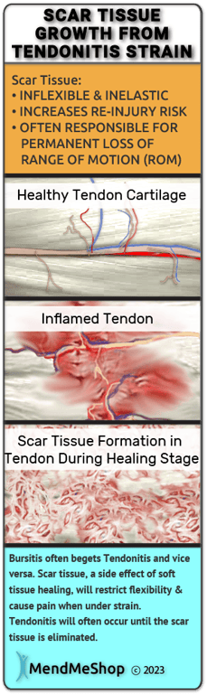 bursitis and tendinitis commonly occur together