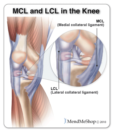 The Medial Collateral Ligament (MCL)