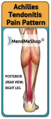 Achilles tendon pain typically begins at the back of foot and radiates up leg depending on severity