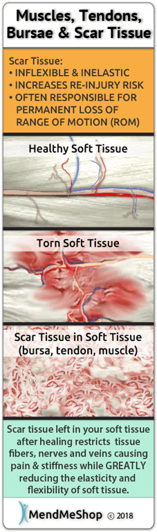 Muscle tissue tears will heal with massive amounts of scar tissue that's brittle, inflexible and will cause pain and stiffness.