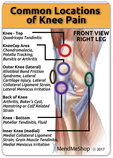 Knee strain or sprain, which is affected 