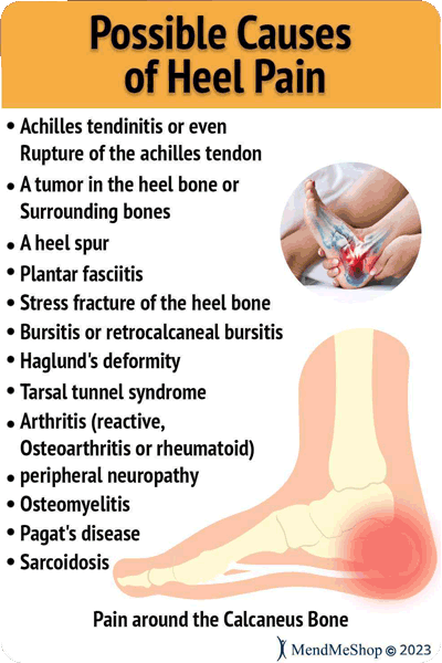there are many possible causes of heel pain