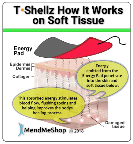 Back-Hip T•Shellz Wrap overview