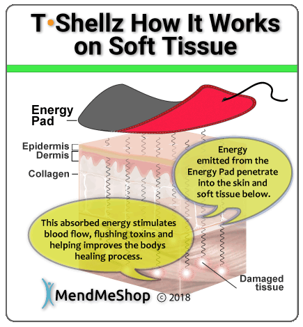 how TShellz heats soft tissue