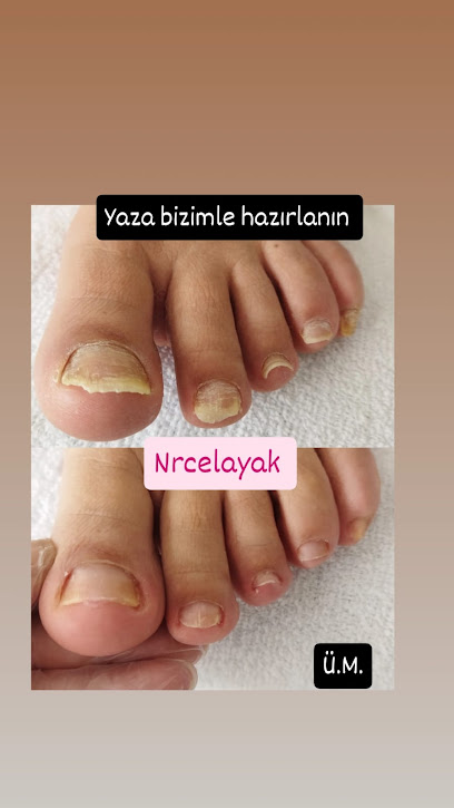 NRC EL AYAK BAKIM MERKEZİ
