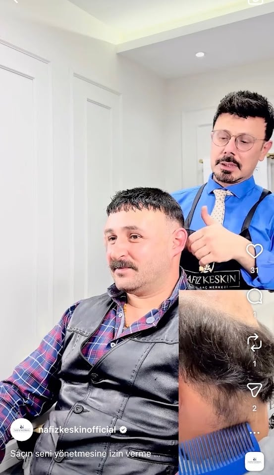 Konya Protez Saç Nafiz Keskin Kliniği