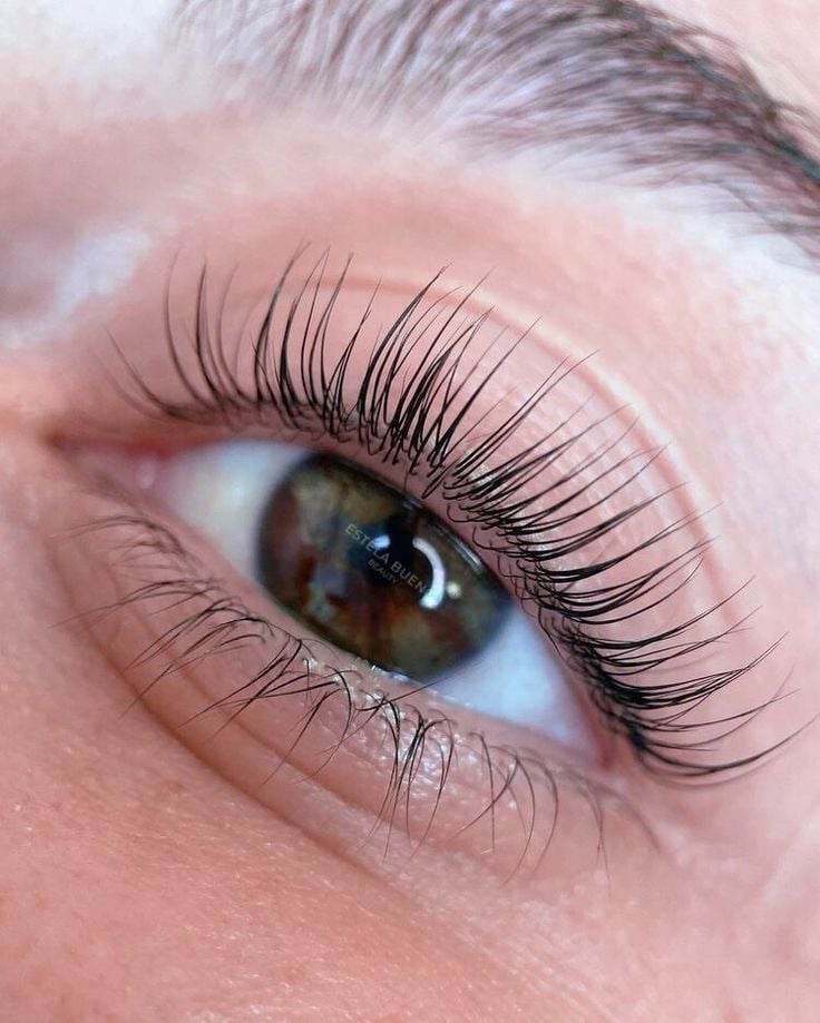 Scalp kayseri