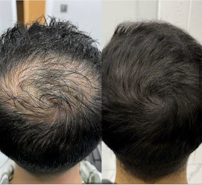 ENZA BEAUTY LEVENT KAĞITHANE GÜZELLİK MERKEZİ LAZER EPİLASYON CİLT BAKIMI ZAYIFLAMA