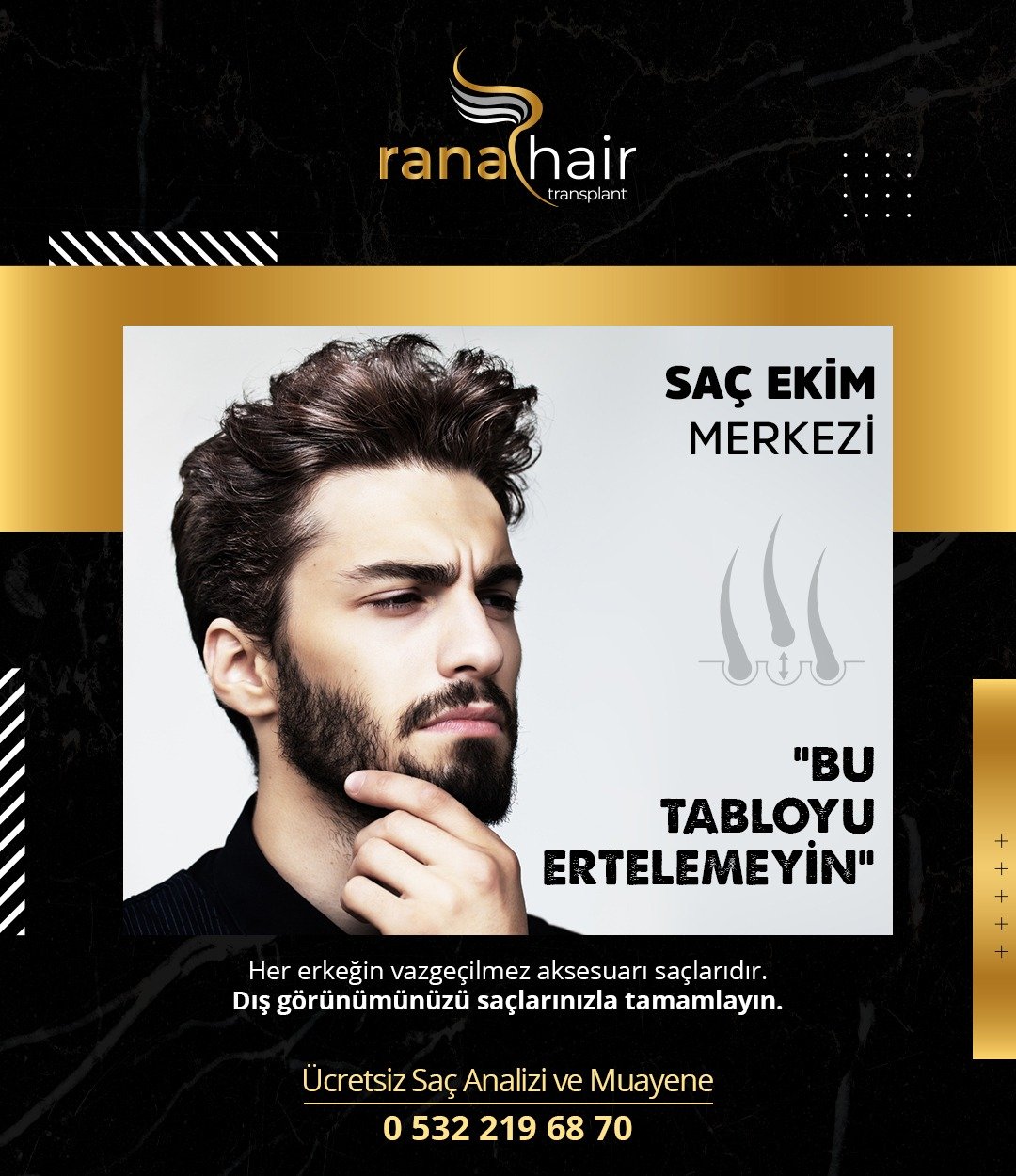 Mersin Rana Saç Ekim Merkezi