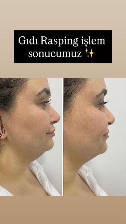Dermavise Ankara Mamak Güzellik Merkezi