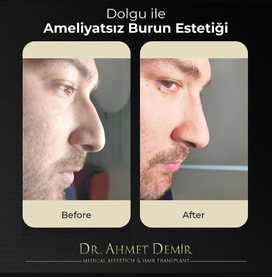 İstanbul Estetik ve Saç Merkezi / İstanbul Aesthetic and Hair Center
