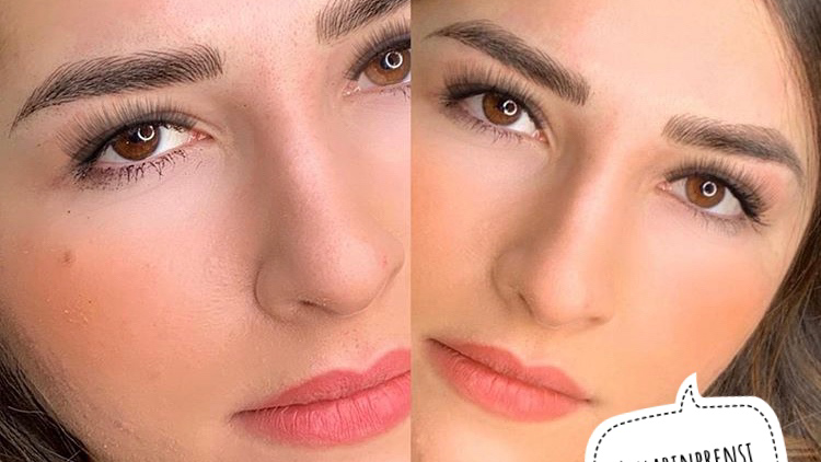 DEVASA GÜZELLİK & DÖVME SİLME MERKEZİ