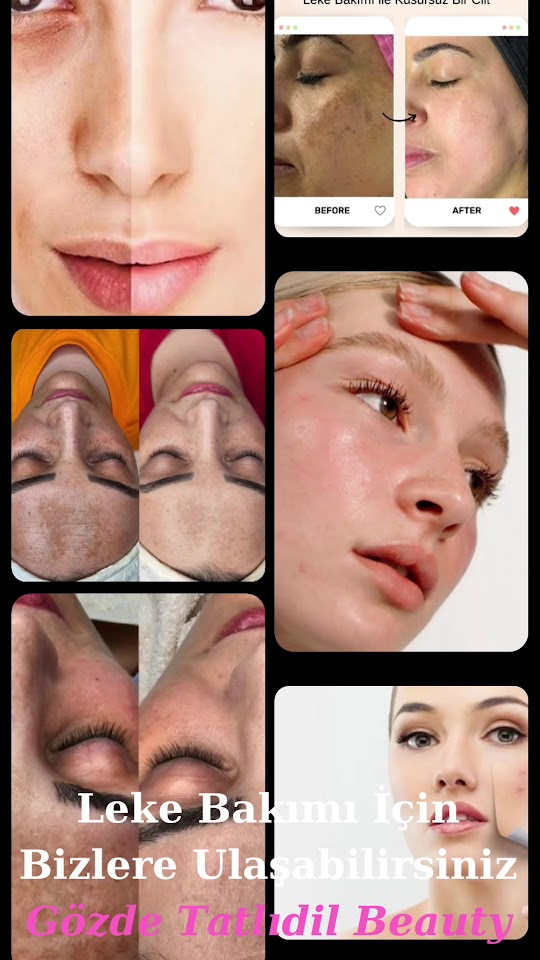 Gözde Tatlıdil Beauty & Microblading & Lazer Epilasyon